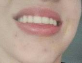 Elter