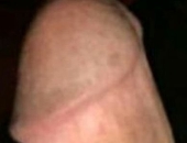 Smurf71
